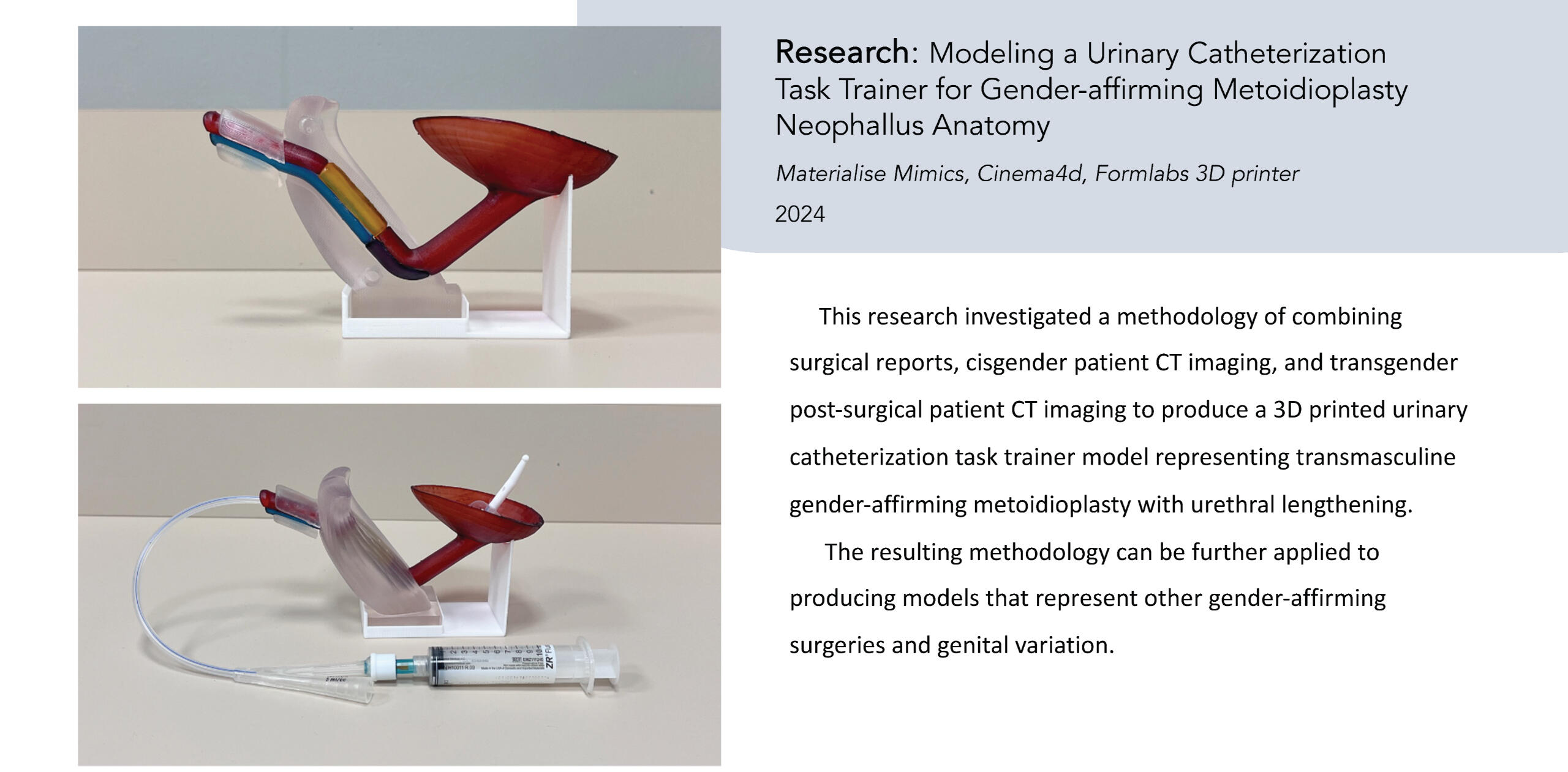 Graduate Research: 3D Printed Urinary Catheterization Clinical Simulation Model Representing Transmasculine Metoidioplasty Post-Operative Anatomy